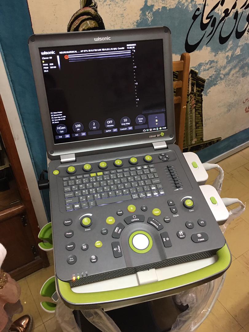 دستگاه سونوگرافی داپلر ترانس کرانیال